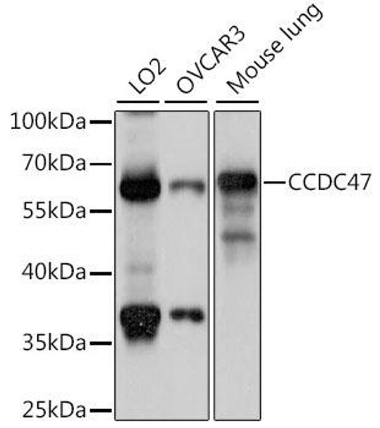 Cell Biology Antibodies 6 Anti-CCDC47 Antibody CAB15871