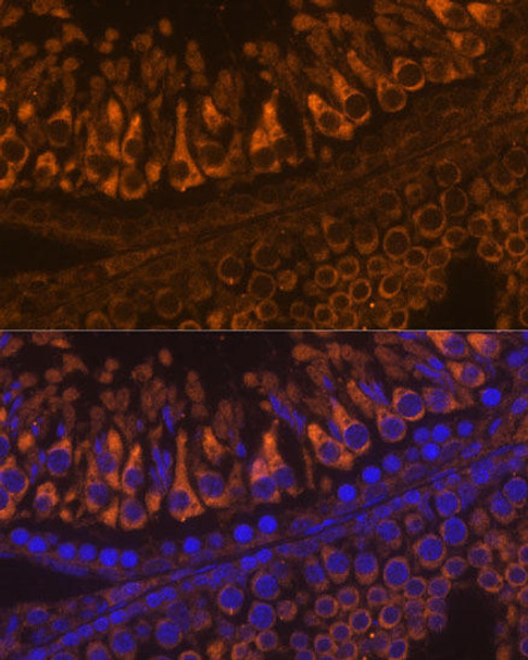 Developmental Biology Anti-ELSPBP1 Antibody CAB15882