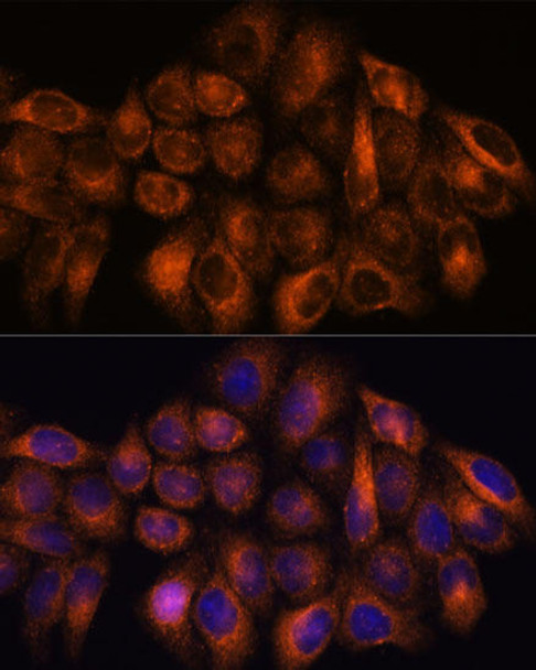 Cell Biology Antibodies 6 Anti-MMP25 Antibody CAB15886