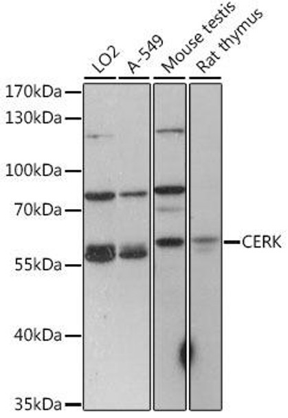 Cell Biology Antibodies 6 Anti-CERK Antibody CAB15889