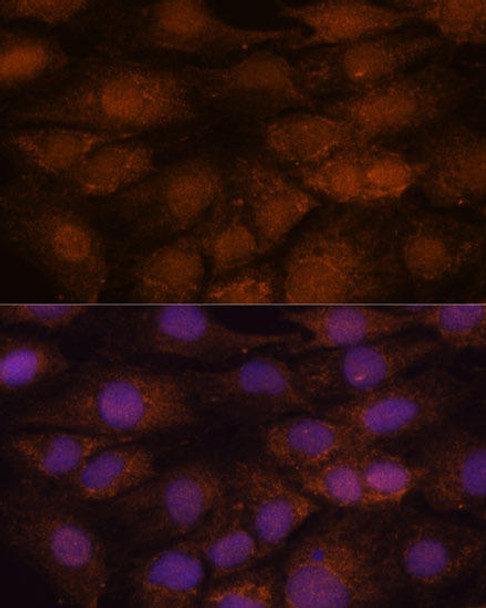 Epigenetics and Nuclear Signaling Antibodies 2 Anti-CEP85 Antibody CAB15891