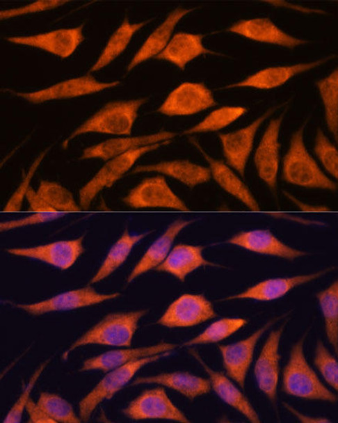 Epigenetics and Nuclear Signaling Antibodies 2 Anti-UPF3A Antibody CAB15893