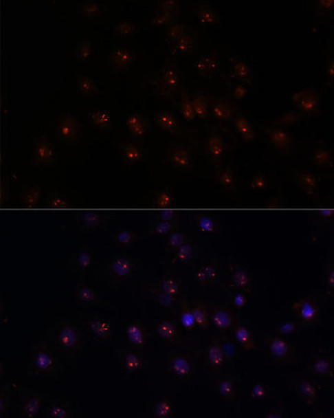 Cell Biology Antibodies 6 Anti-METTL16 Antibody CAB15894