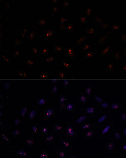 Cell Biology Antibodies 6 Anti-METTL16 Antibody CAB15894