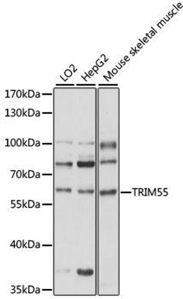 Cell Biology Antibodies 6 Anti-TRIM55 Antibody CAB15917