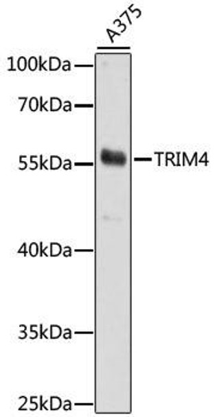 Immunology Antibodies 2 Anti-TRIM4 Antibody CAB15922