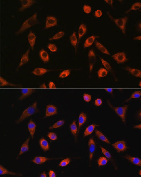 Cell Biology Antibodies 6 Anti-TP53I13 Antibody CAB15924