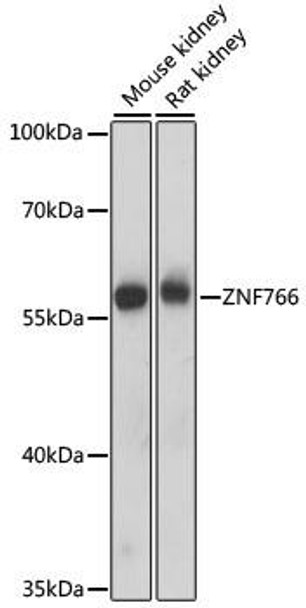 Epigenetics and Nuclear Signaling Antibodies 2 Anti-ZNF766 Antibody CAB15925