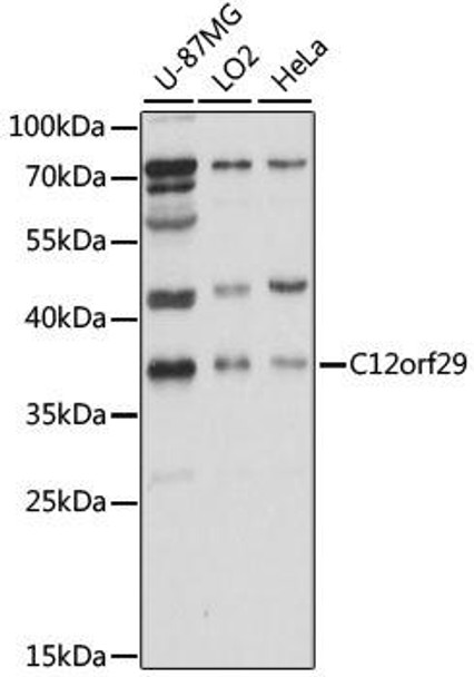 Cell Biology Antibodies 6 Anti-C12orf29 Antibody CAB15927