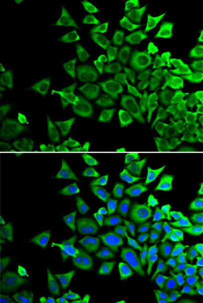 Cell Death Antibodies 1 Anti-BAD Antibody CAB1593