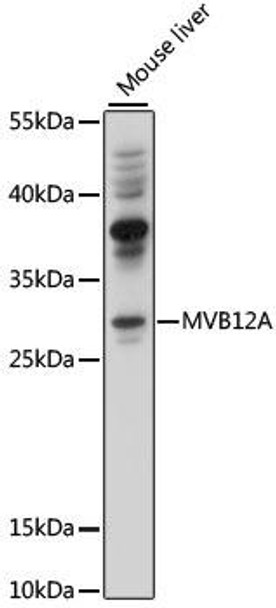 Cell Biology Antibodies 6 Anti-MVB12A Antibody CAB15930