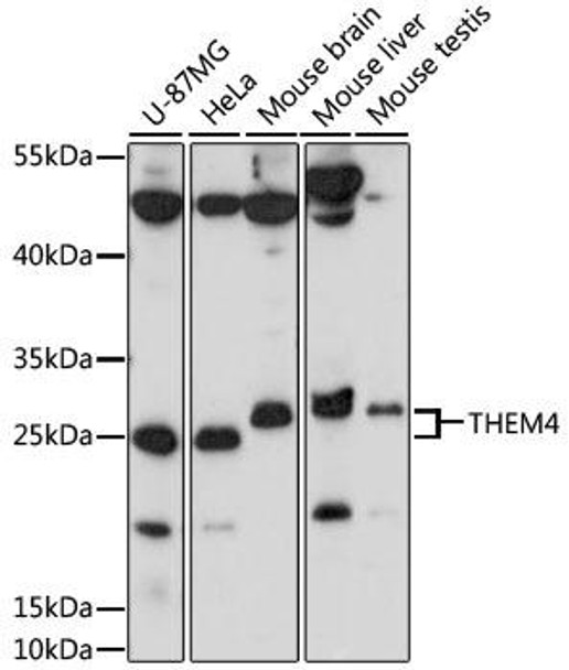 Cell Death Antibodies 1 Anti-THEM4 Antibody CAB15940