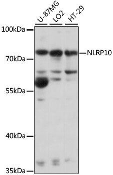 Immunology Antibodies 2 Anti-NLRP10 Antibody CAB15976