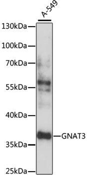 Cell Biology Antibodies 6 Anti-GNAT3 Antibody CAB15982