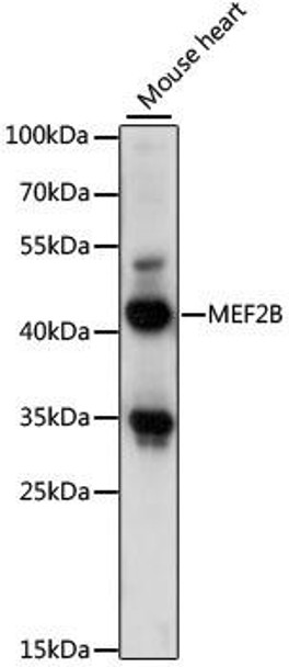 Epigenetics and Nuclear Signaling Antibodies 2 Anti-MEF2B Antibody CAB15986