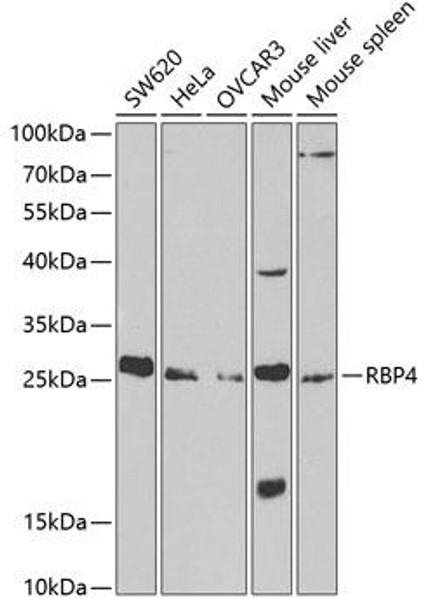 Signal Transduction Antibodies 2 Anti-RBP4 Antibody CAB1600