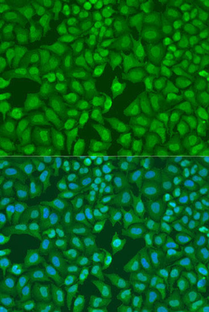 Cell Cycle Antibodies 1 Anti-MonoMethyl-UHRF1-K385 Antibody CAB16008