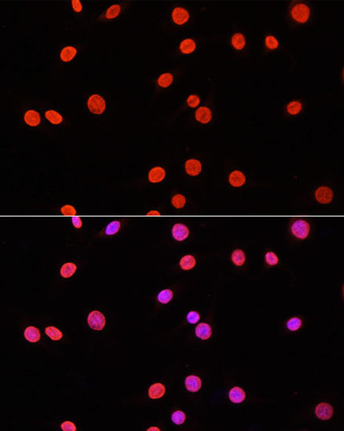 Epigenetics and Nuclear Signaling Antibodies 2 Anti-DiMethyl-DNMT3A-K44 Antibody CAB16012