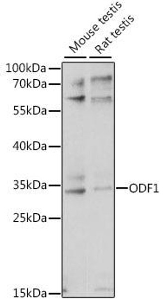 Developmental Biology Anti-ODF1 Antibody CAB16023