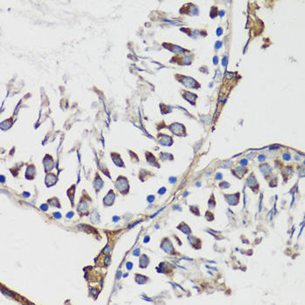 Cell Cycle Antibodies 1 Anti-Cyclin B1 Antibody CAB16038