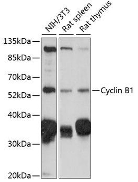 Cell Cycle Antibodies 1 Anti-Cyclin B1 Antibody CAB16038