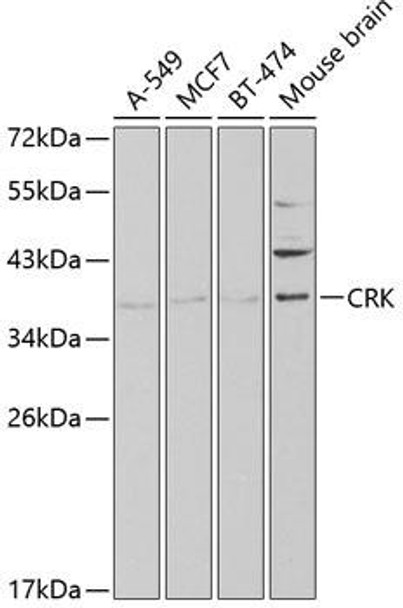 Cell Biology Antibodies 6 Anti-CRK Antibody CAB1604