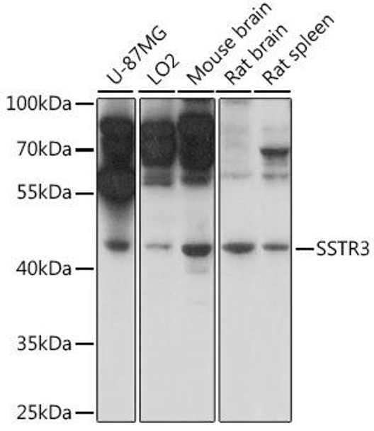 Cell Biology Antibodies 6 Anti-SSTR3 Antibody CAB16071