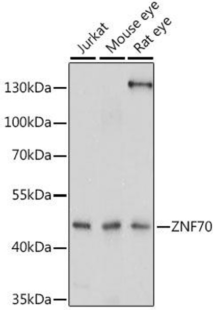 Epigenetics and Nuclear Signaling Antibodies 2 Anti-ZNF70 Antibody CAB16072