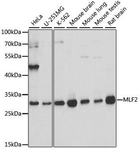 Cell Biology Antibodies 6 Anti-MLF2 Antibody CAB16076