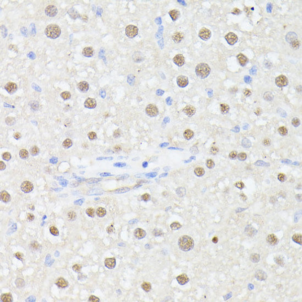 Cell Biology Antibodies 6 Anti-MLF2 Antibody CAB16076