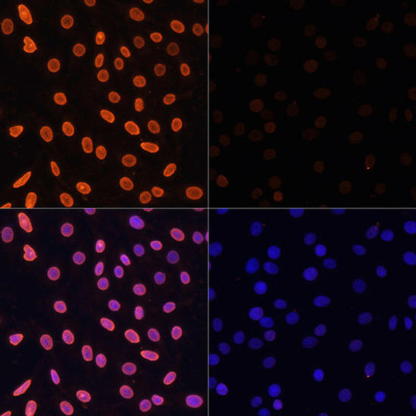 Epigenetics and Nuclear Signaling Antibodies 2 Anti-Acetyl-Histone H3-K36 Antibody CAB16077