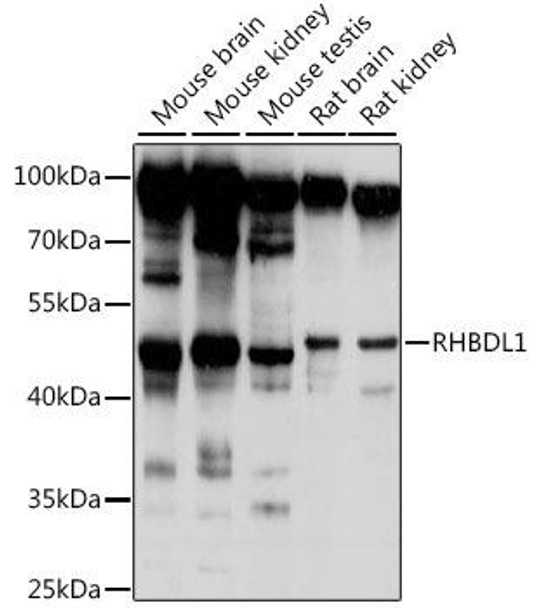 Cell Biology Antibodies 6 Anti-RHBDL1 Antibody CAB16084