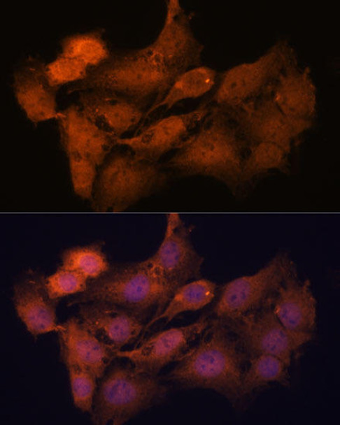 Cell Cycle Antibodies 1 Anti-SYCP2 Antibody CAB16098