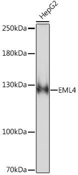 Cell Biology Antibodies 6 Anti-EML4 Antibody CAB16117