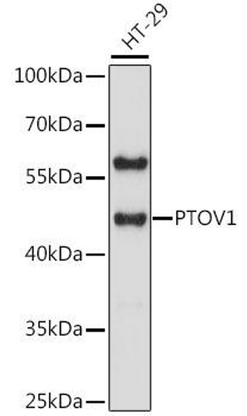 Epigenetics and Nuclear Signaling Antibodies 2 Anti-PTOV1 Antibody CAB16126