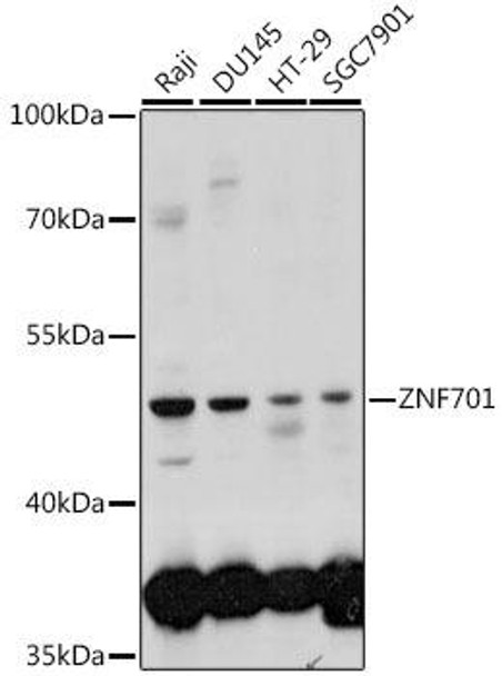 Epigenetics and Nuclear Signaling Antibodies 2 Anti-ZNF701 Antibody CAB16133