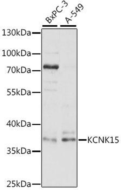 Signal Transduction Antibodies 2 Anti-KCNK15 Antibody CAB16140