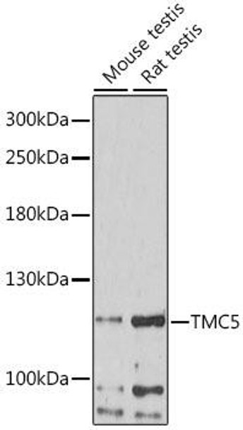 Signal Transduction Antibodies 2 Anti-TMC5 Antibody CAB16145