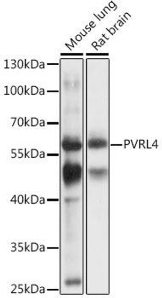 Cell Biology Antibodies 6 Anti-PVRL4 Antibody CAB16149