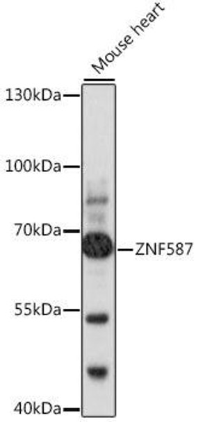 Epigenetics and Nuclear Signaling Antibodies 2 Anti-ZNF587 Antibody CAB16156