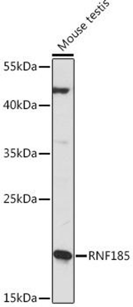 Autophagy Antibodies Anti-RNF185 Antibody CAB16158