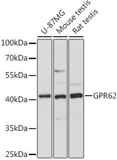 Cell Biology Antibodies 6 Anti-GPR62 Antibody CAB16163