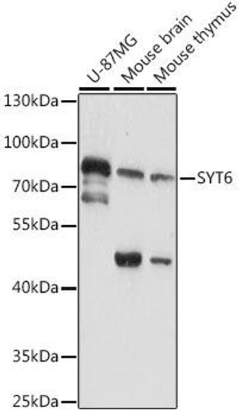 Cell Biology Antibodies 6 Anti-SYT6 Antibody CAB16171