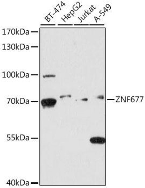 Epigenetics and Nuclear Signaling Antibodies 2 Anti-ZNF677 Antibody CAB16183