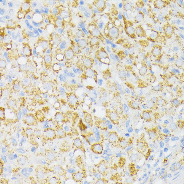 Cell Biology Antibodies 6 Anti-USP33 Antibody CAB16187