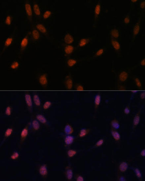 Cell Biology Antibodies 6 Anti-USP33 Antibody CAB16187