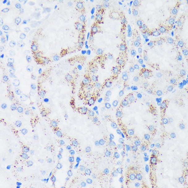 Cell Biology Antibodies 6 Anti-GTPBP8 Antibody CAB16189