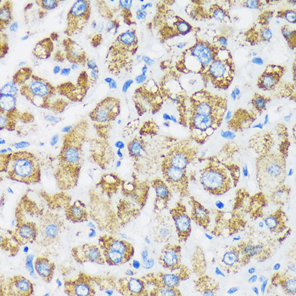 Cell Biology Antibodies 6 Anti-GTPBP8 Antibody CAB16189