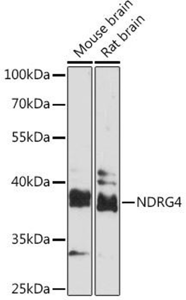 Cell Biology Antibodies 6 Anti-NDRG4 Antibody CAB16195