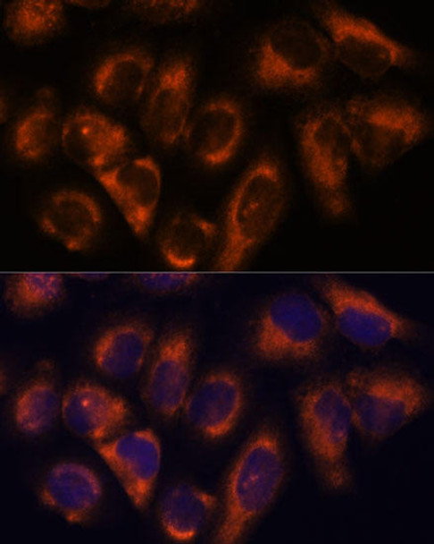 Cell Biology Antibodies 6 Anti-NDRG4 Antibody CAB16195